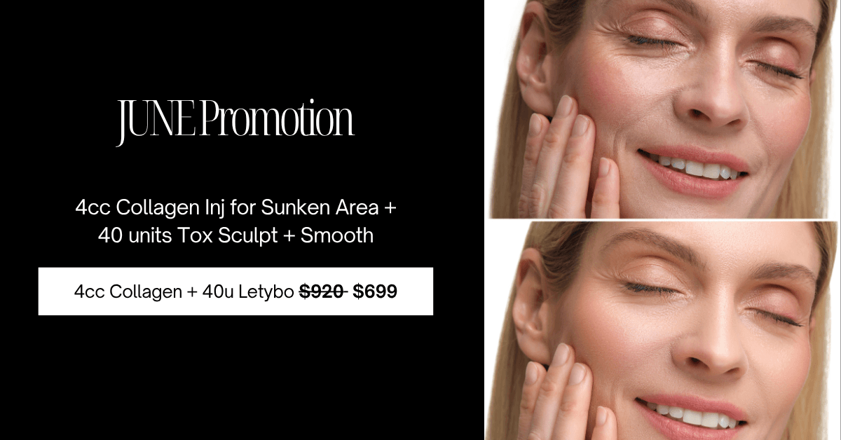 Promotion 4